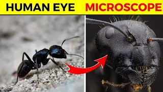 15 Things You Can See Only Under Microscope | Rewirs Facts