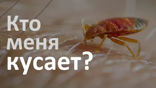 Определитель укусов: как понять, кто кусает в доме?