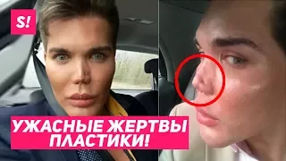 САМЫЕ ЖУТКИЕ ЖЕРТВЫ ПЛАСТИКИ / ЖИВЫЕ "КЕНЫ" 😨😱