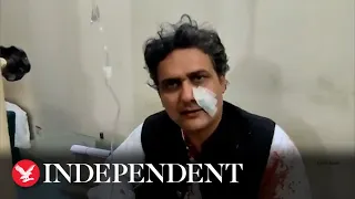 Imran Khan: Bloodied Pakistan senator speaks after former PM's 'assassination attempt'