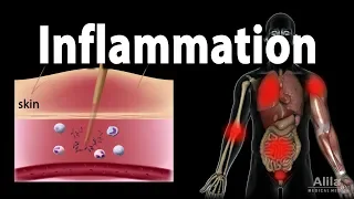 Inflammatory Response, Animation