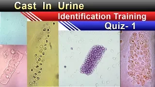 Urine Cast Identification Training Quiz -1