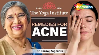 Remedies for Acne | Natural Beauty Tips | Dr. Hansaji Yogendra | The Yoga Institute | Health Tips