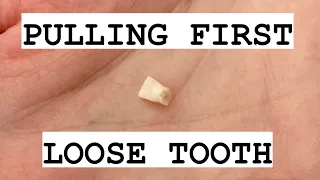 PULLING LOOSE TOOTH | new method to pull loose teeth