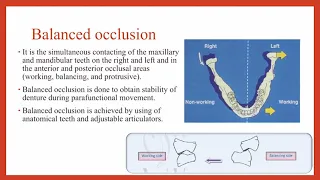 2-13 Prosthodontics, Occlusion.