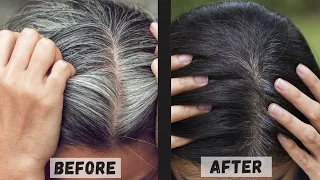 30 Days Challenge : Reverse Grey Hair Naturally in 30 Days | Premature Grey Hair Causes & Remedy