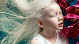 Сибирская Белоснежка: альбинос из Якутии поразила весь мир уникальной красотой!