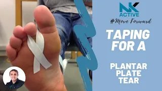 Taping for a Plantar Plate injury  | tear / treatment / injuries