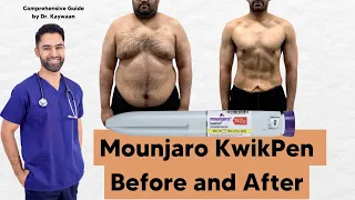 How to use Mounjaro KwikPen for Weight Loss (Comprehensive Guide)