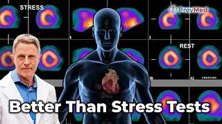The Truth About Nuclear Stress Tests