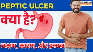 😨Peptic Ulcer(पेट में अल्सर) | Peptic Ulcer क्या है? | Peptic Ulcer लक्षण, कारण, और इलाज in Hindi