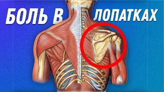 Боль в лопатках | Остеопат Марина Просветина