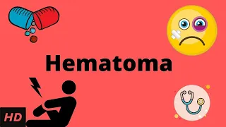 Hematoma, Causes, Signs and Symptoms, Diagnosis and Treatment.