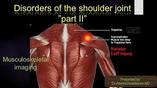 2-Disorders of the shoulder joint part II