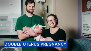 2 sets of twins born to moms with double uterus delivered at same hospital