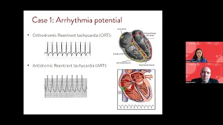 Children's Week 2022: Evaluation and Management of Pediatric Cardiac Arrhytmias