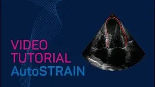 AutoSTRAIN Video Tutorial #TTA2.30