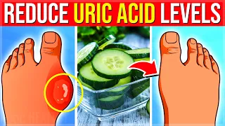 17 POWERFUL Super Foods That Reduce Your Uric Acid Levels