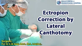 Ectropion Correction by Lateral Canthotomy