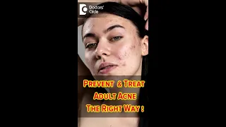 Adult Acne: Causes,  Prevention, and Treatment- Dr. Aruna Prasad | Doctors' Circle #shorts