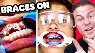 How Braces Are Put On - Watch Before You Get Braces!