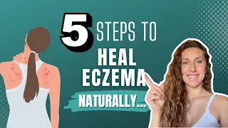 Sick of The Itch? 5 Steps To Heal Eczema Naturally