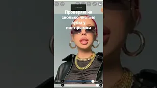 проверила на сколько чистые зубы у инстасамки!😱кого проверить ещё?