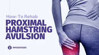 How to Rehab Proximal Hamstring Avulsion