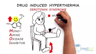 Emergency Medicine - Hyperthermia: By Anjali Hulbanni M.D. and Mudassir Khan M.D.