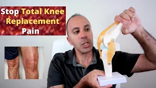 Stop Total Knee Replacement (TKR) Pain Naturally: Symptoms, Causes, Healing Cycle & Treatment