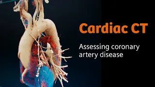 Cardiology: How CT imaging captures the rhythm of the human heart