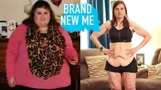 My 260lbs Weight Loss Left Me With 20lbs Of Loose Skin | BRAND NEW ME