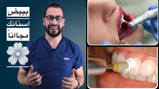 شرح اسهل طريقة لتبييض الاسنان عند  الطبيب بدون اي مشاكل او مضاعفات
