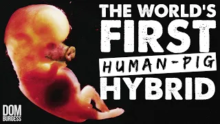 How Scientists Made the World's First Human-Pig Hybrid
