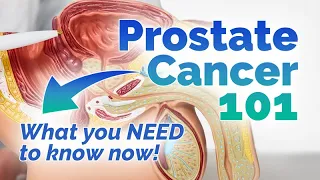 What You Need To Know About Prostate Cancer