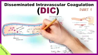 DIC: Disseminated Intravascular Coagulation / Part 1