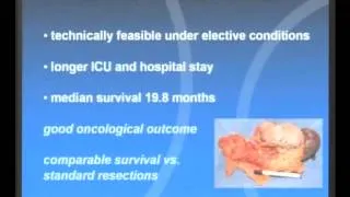 International Meeting - Pancreatic Resections: an update