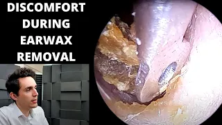 Discomfort And Haematoma During Ear Wax Removal Discussed