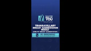 Transaxillary Breast Augmentation Results, Before and After Results of Breast Enlargement Surgery