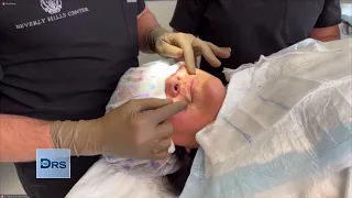 Woman’s 10-Minute Procedure to Address Her RBF