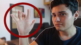 QUE ME PASO EN LA MANO?