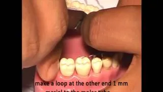 Orthodontic Wire Bending Exercises [Part 2-6] Niti 0.014 Adjustment Loop