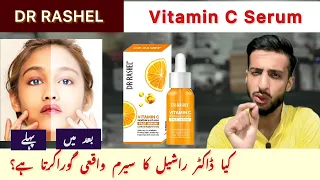Dr Rashel Vitamin C Face Serum | HONEST REVIEW | Uses, Side effects