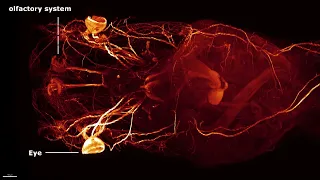 Nervous system of Xenopus tadpole imaged at 5x magnification.