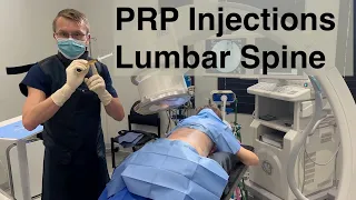 Treating Back Pain and Sciatica with PRP Injections