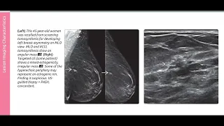 BREAST DIAGNOSTIC IMAGING SERIES(2)