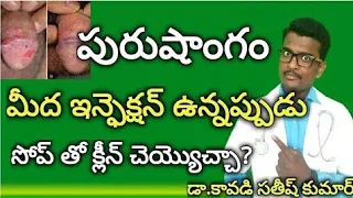 Is Cleaning Penis With Soap Good Or Bad ?| In Telugu | Doctor Satheesh || Yes1TV LifeCare