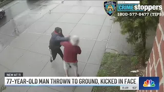 Caught on Camera: NYC Man Throws 77-Year-Old to Ground Before Kicking Him in the FACE | NBC New York