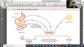 Gastro Davidson Marking