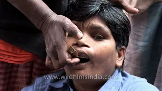 Roadside dentist shows how he makes false teeth